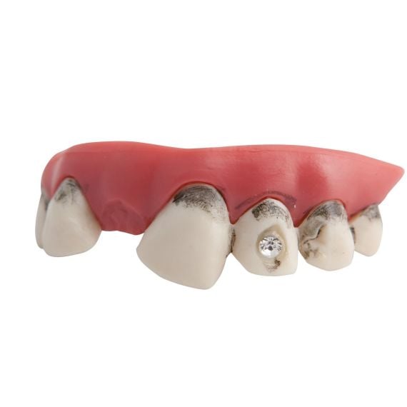 Dentier Vieilles Dents et Faux Diamant - accessoire humour pas cher -  Badaboum